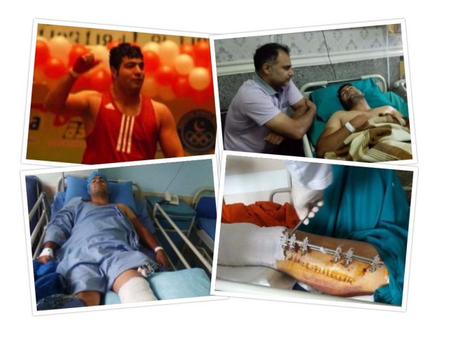 علی سلمانی بوکسور ملی پوش گیلان در بیمارستان چشم انتظار کمک/عاقبت بی‌توجهی به ورزشکار ملی پوشی که دستفروشی می‌کرد